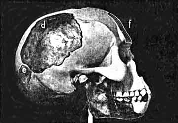 Piltdown Skull