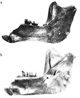 Lower Jaw Bones: Pilt,  Arang