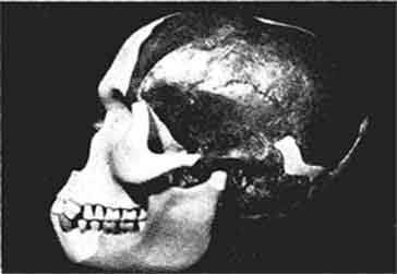 The Piltdown skull.  Combination of man and Orangutang